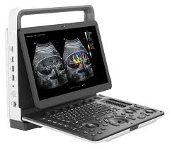 Portabe M 30 Ultrasound Machine